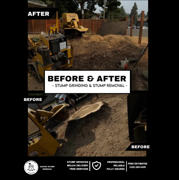 Before&After18